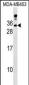 LIN7A Antibody (C-term)